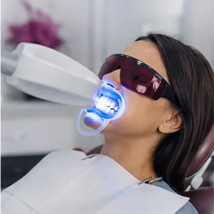 Sessão profissional de clareamento dental